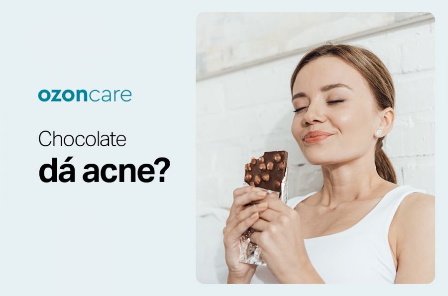 Chocolate dá acne?       