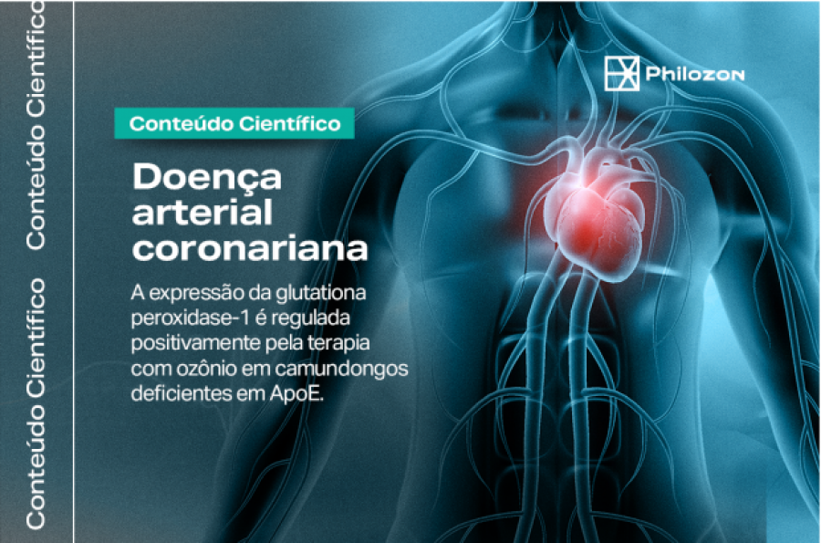 Conteúdo Científico: Doença arterial coronariana