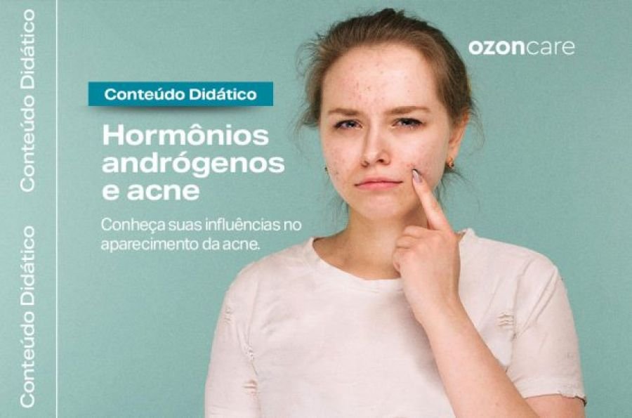 Você sabia que os hormônios andrógenos podem influenciar no aparecimento da acne?